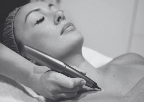 Cryopen - Cryosurgery